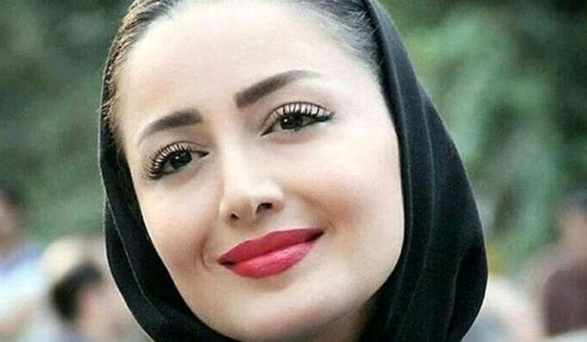 چهره شیلا خداداد قبل از عمل زیبایی سوژه شد! +تصاویر دونفره شیلا خداداد