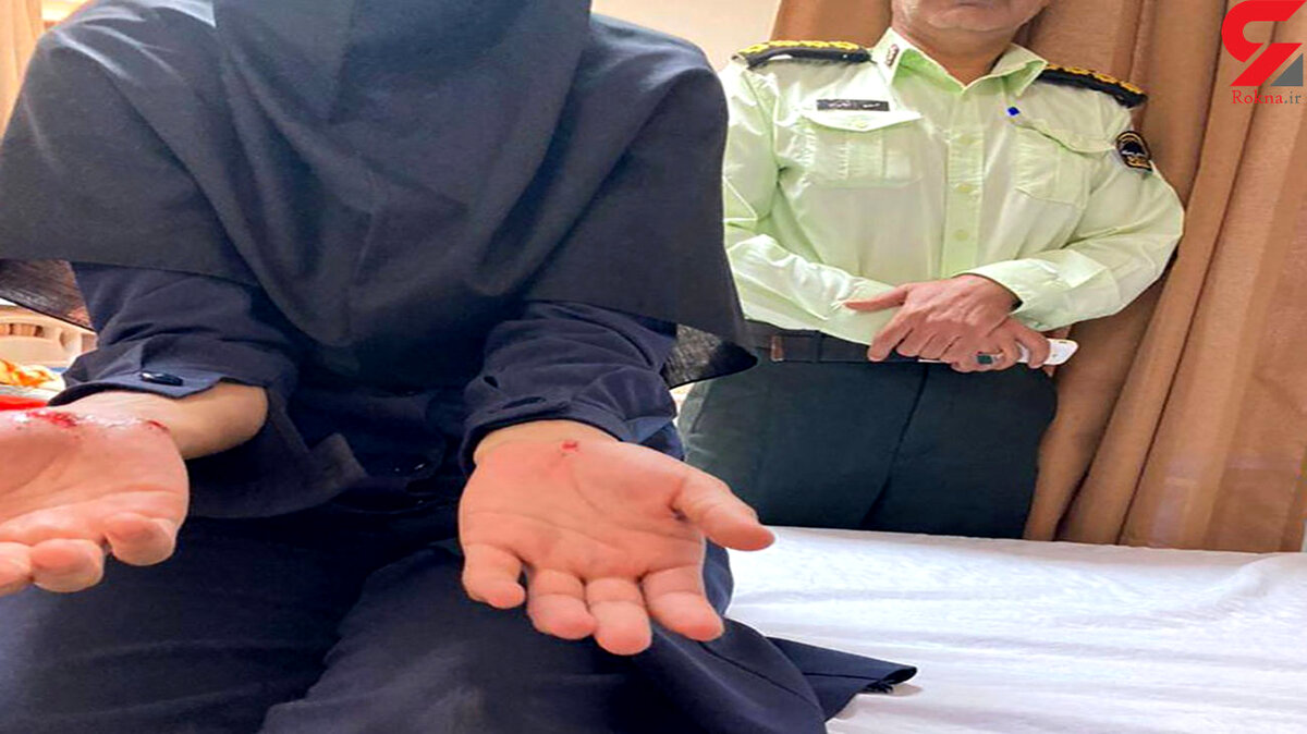 حمله خونین سگ بدون صاحب به زن جوان در کرمان / پلیس فرشته نجات زن جوان شد + عکس