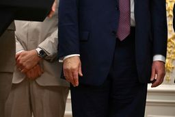 ترامپ مبتلا به بیماری جذام است؟