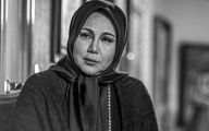 پشیمانی های بهنوش بختیاری از عمل جراحی+عکس
