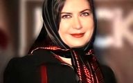 تغییر شوکه کننده لعیا زنگنه بعد از مدت ها همه رو مبهوت کرد | لعیا زنگنه بعد از جراحی زیبایی شده عین 20 ساله ها