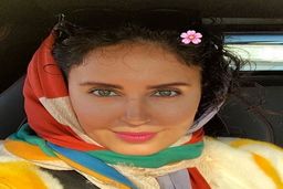 رونمایی الناز شاکردوست از چهره جدیدش بعد از عمل | جراحی زیبایی الناز شاکردوست همه رو خیره کرد