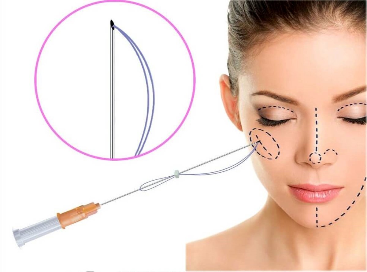 لیفت نخ چقدر ماندگاری دارد؟