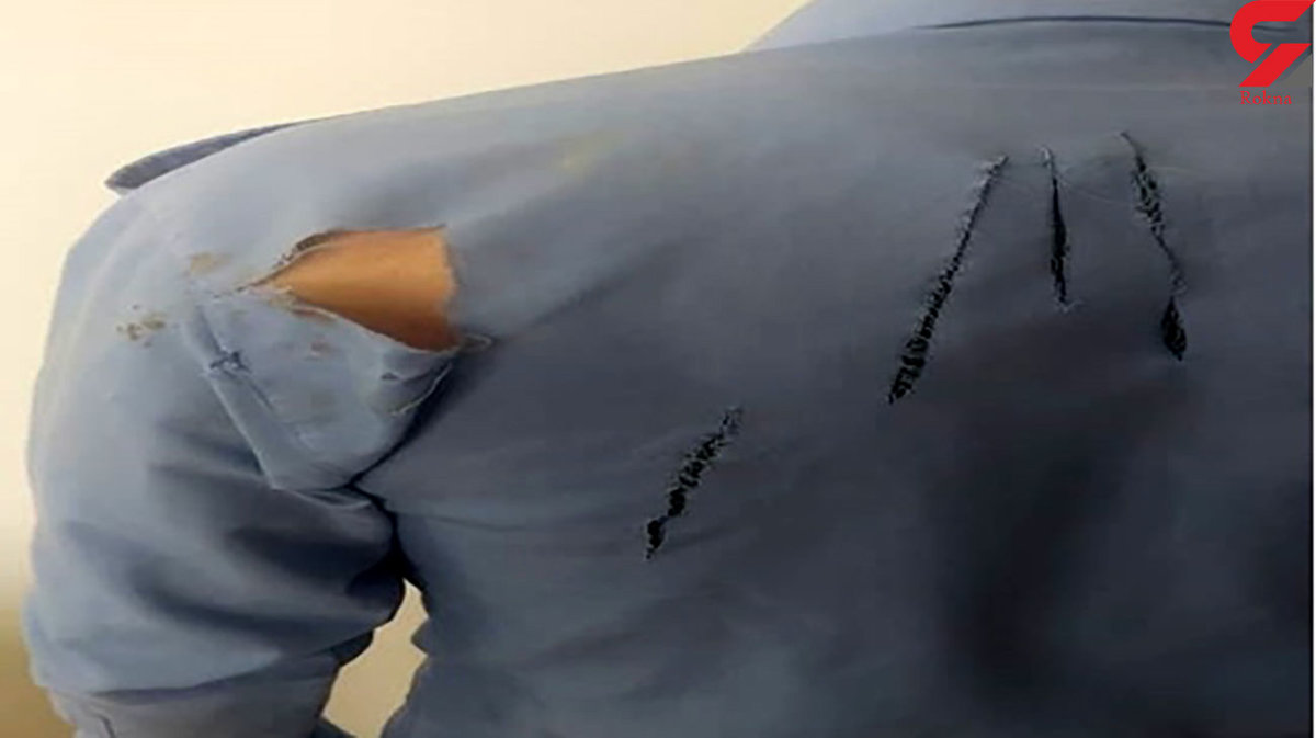 عکس لباس پاره شده مرد واکسیناتور / حمله سگ از پشت سر در ایذه