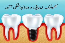 خدمات دندانپزشکی با شرایط پرداخت اقساط