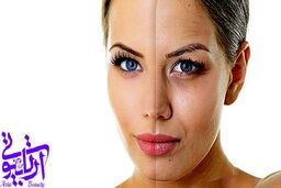 بهترین و سریعترین روش برای جوانسازی پوست