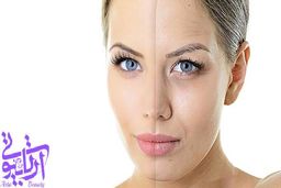 بهترین و سریعترین روش برای جوانسازی پوست