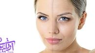 بهترین و سریعترین روش برای جوانسازی پوست