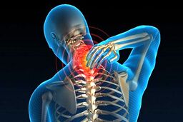 تغییر در سبک زندگی عامل شیوع سردردهایی گردنی
