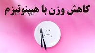 چرا  "هیپنوتیزم درمانی" برای کاهش وزن مناسب است؟