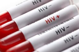 ویروس HIV به متابولیسم کلسترول آسیب می‌رساند