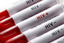 ویروس HIV به متابولیسم کلسترول آسیب می‌رساند