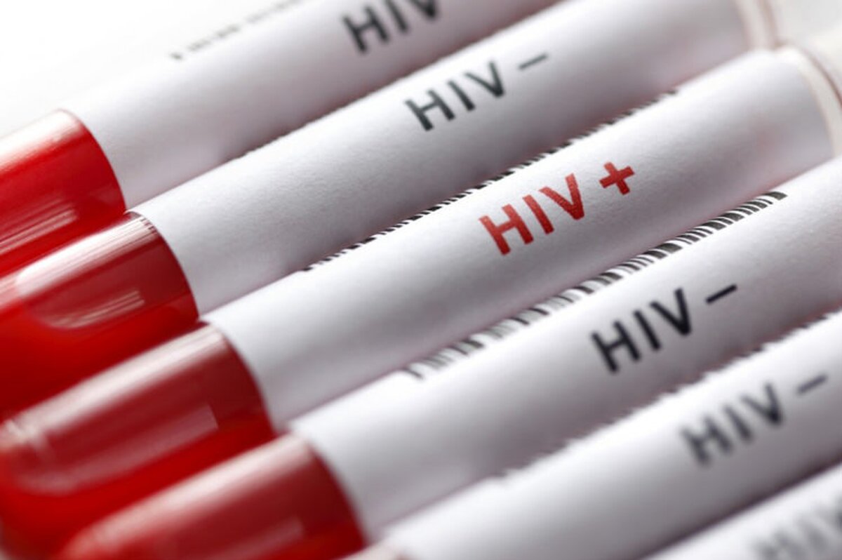 ویروس HIV به متابولیسم کلسترول آسیب می‌رساند