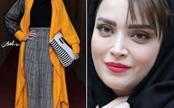 بهنوش طباطبایی بازم رفت زیر تیغ جراحی | عکس جدید بهنوش طباطبایی بعد از عمل زیبایی