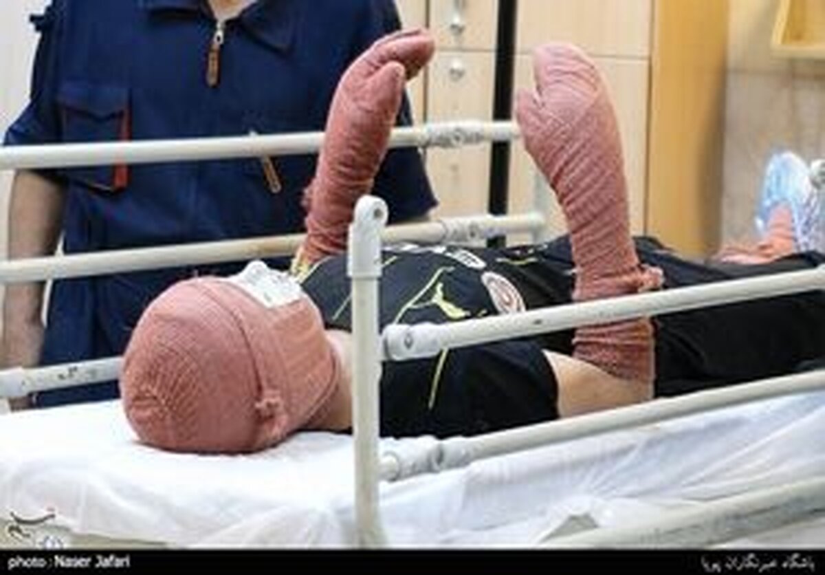 نارنجک بلای جان کودک ۱۴ ساله در شهرری شد