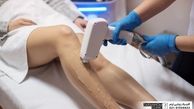 لیزر موهای زائد در چه نواحی از بدن انجام می شود؟