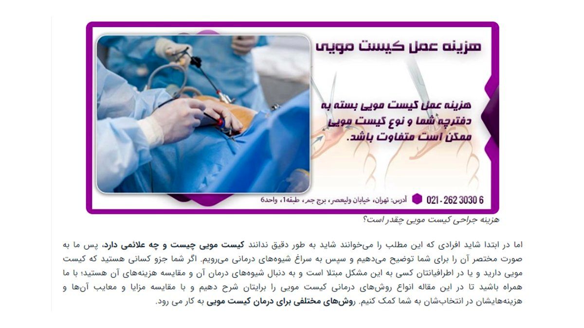 هزینه لیزر کیست مویی و شرایط پرداخت آن در سال 1402 چه تغییراتی کرده است؟