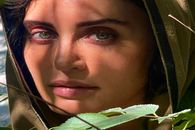 رونمایی الناز شاکردوست از چهره جدیدش بعد از عمل | جراحی زیبایی الناز شاکردوست همه رو خیره کرد