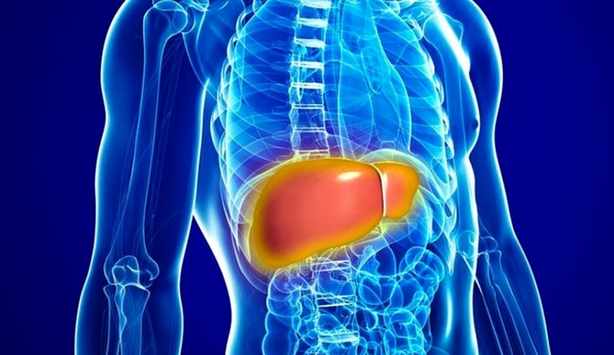 بروز سونامی مبتلایان کبد چرب در آیندهای نزدیک