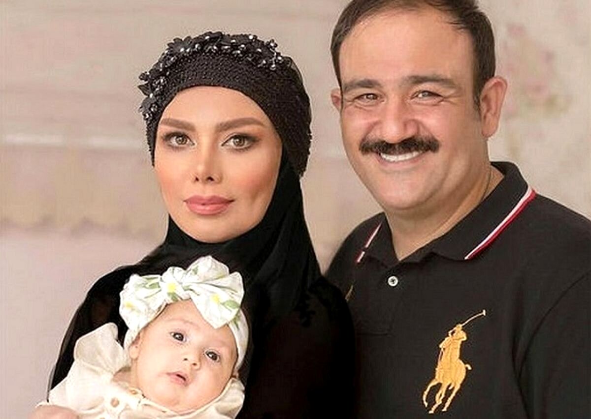 تغییر چهره مهران غفوریان بعد از عمل جراحی