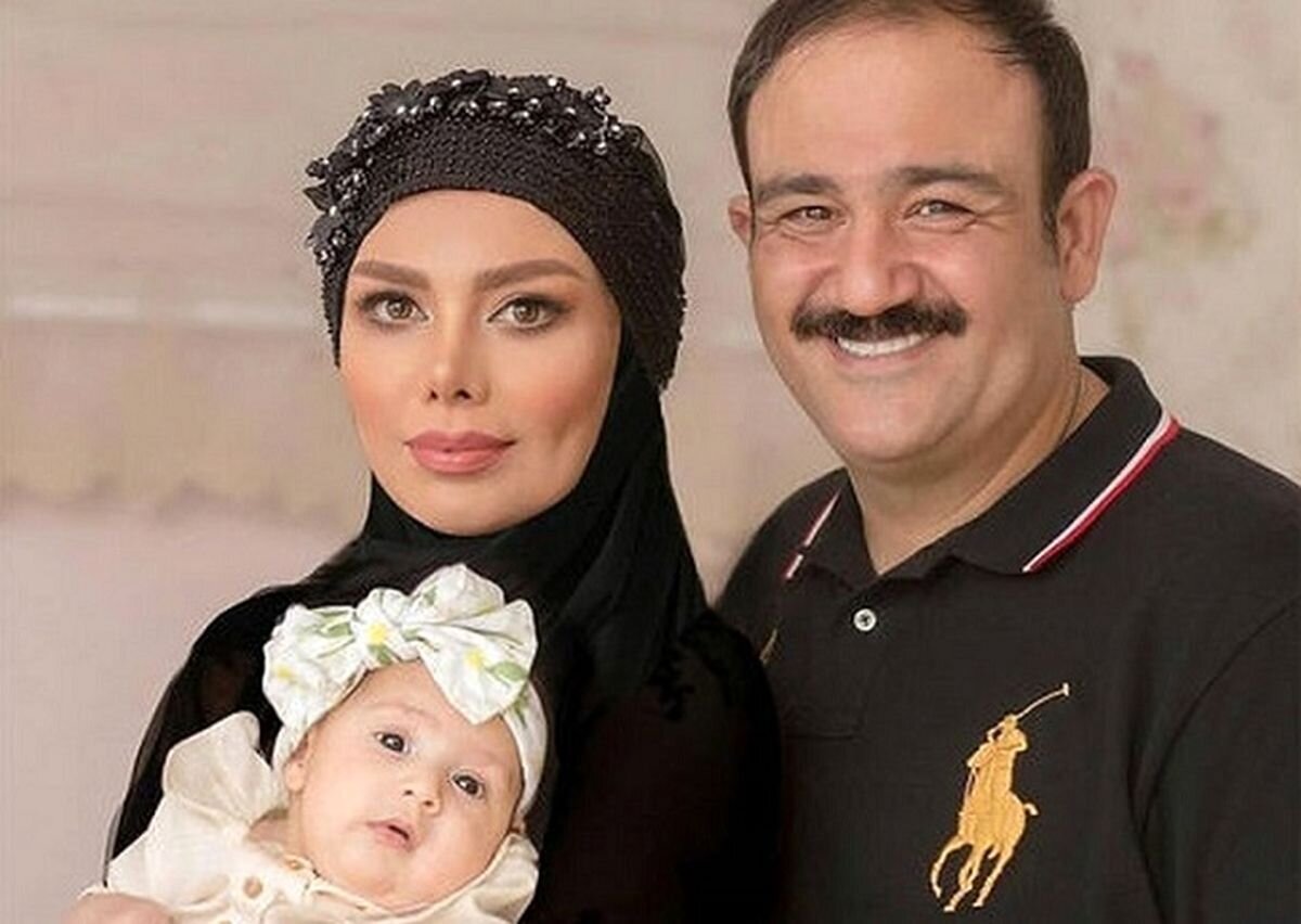 تغییر چهره مهران غفوریان بعد از عمل جراحی