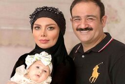 تغییر چهره مهران غفوریان بعد از عمل جراحی