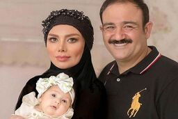 تغییر چهره مهران غفوریان بعد از عمل جراحی