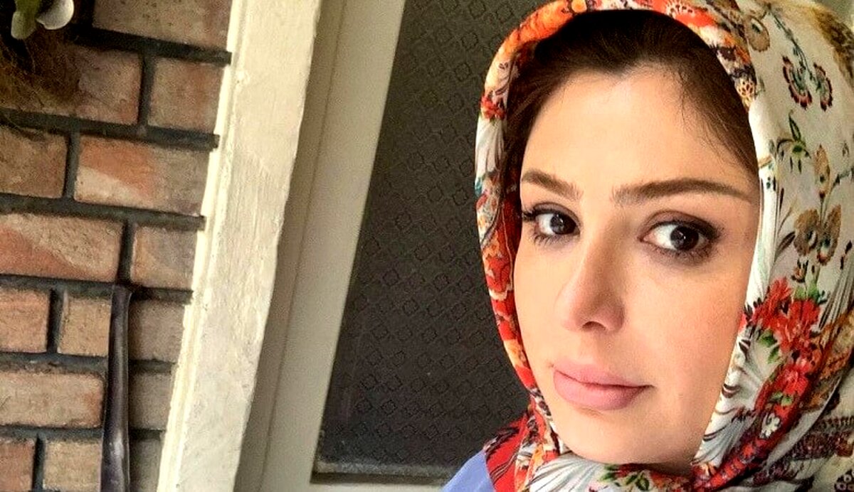 صورت خون آلود نیوشا ضیغمی