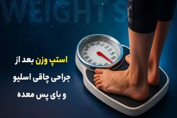 استپ وزن بعد از جراحی چاقی اسلیو و بای پس معده